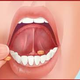Illustration for article titled Obat Stroke Di Bawah Lidah